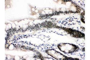 Image no. 1 for anti-CCCTC-Binding Factor (Zinc Finger Protein) (CTCF) (AA 521-727) antibody (ABIN3043817)