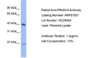 Image no. 2 for anti-Protein Kinase A, alpha (PRKACA) (N-Term) antibody (ABIN2787415)