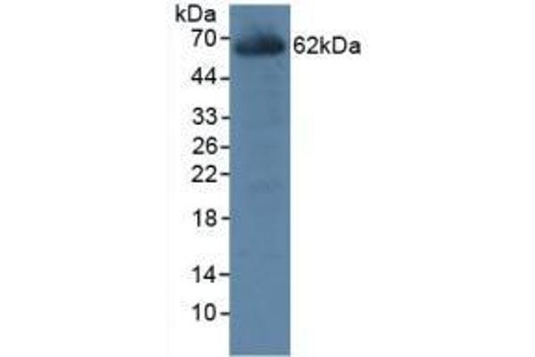 CES1 抗体  (AA 19-300)