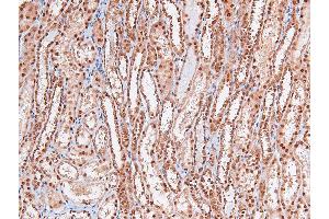 Image no. 5 for anti-V-Raf Murine Sarcoma 3611 Viral Oncogene Homolog (ARAF) (pSer299) antibody (ABIN6271430)