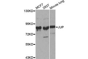 Image no. 3 for anti-Junction Plakoglobin (JUP) antibody (ABIN3021168)