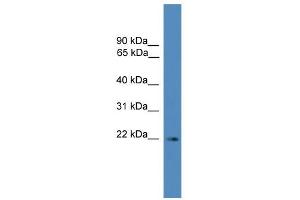 WB Suggested Anti-SSX3 Antibody Titration: 0.