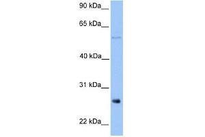 Image no. 1 for anti-Methyltransferase Like 7B (METTL7B) (Middle Region) antibody (ABIN631547)