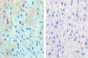 Image no. 1 for anti-Carnitine Palmitoyltransferase 1A (Liver) (CPT1A) (AA 606-636), (C-Term) antibody (ABIN389101)
