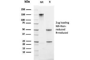Image no. 6 for anti-Antigen Identified By Monoclonal Antibody Ki-67 (MKI67) (AA 2293-2478) antibody (ABIN6940052)