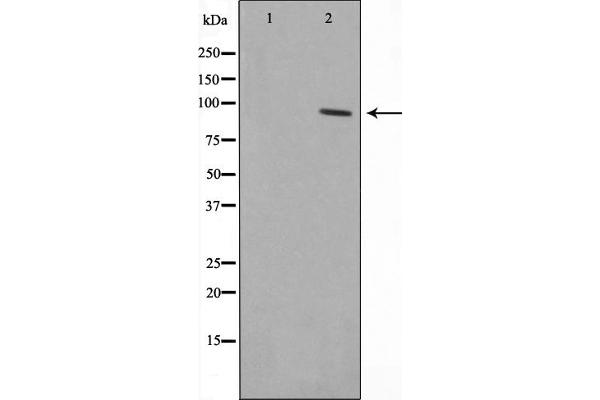 anti-Zinc Finger Protein 148 (ZNF148) (N-Term) antibody