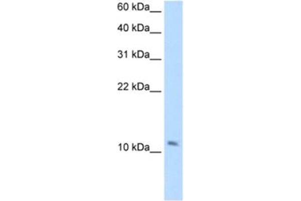 anti-Small Muscle Protein, X-Linked (SMPX) antibody