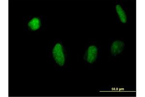 Immunofluorescence of purified MaxPab antibody to MSL3L1 on HeLa cell.