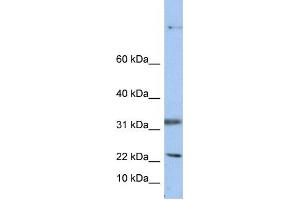 Western Blotting (WB) image for anti-15 KDa Selenoprotein (SEP15) antibody (ABIN2459187)