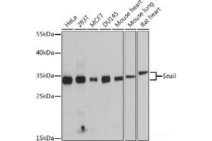 Western blot analysis of extracts of various cell lines using Snail Polyclonal Antibody at dilution of 1:1000.
