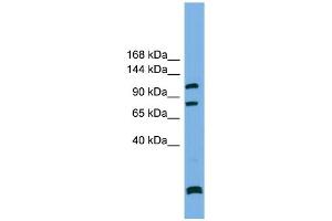 Image no. 2 for anti-SAPS Domain Family, Member 1 (SAPS1) (N-Term) antibody (ABIN2786061)