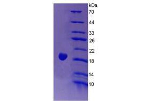 Endothelin 1 (EDN1) (AA 54-202) (Active) protein (His tag)