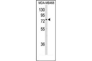 Image no. 2 for anti-Exostosin 2 (EXT2) (AA 188-218), (Middle Region) antibody (ABIN952145)