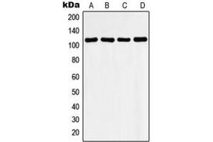Image no. 3 for anti-Histone Deacetylase 9 (HDAC9) (C-Term) antibody (ABIN2704894)
