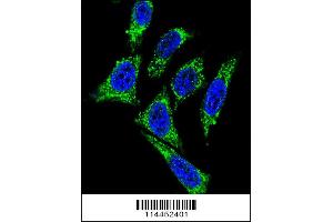 Image no. 1 for anti-Midkine (Neurite Growth-Promoting Factor 2) (MDK) (AA 113-143), (C-Term) antibody (ABIN656014)
