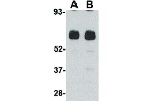 Image no. 2 for anti-Unc-93 Homolog B1 (UNC93B1) (N-Term) antibody (ABIN6656812)