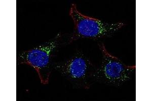 Fluorescent confocal image of HeLa cells stained with PDK4 antibody.