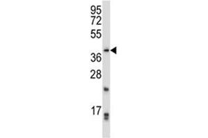 Image no. 2 for anti-Paired-Like Homeodomain 2 (PITX2) (AA 42-71) antibody (ABIN3032140)