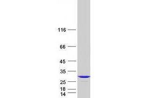 Image no. 1 for Phosphatidylcholine Transfer Protein (PCTP) (Transcript Variant 1) protein (Myc-DYKDDDDK Tag) (ABIN2728453)