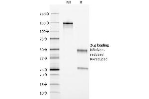 Image no. 4 for anti-Ferritin, Light Polypeptide (FTL) (AA 38-165) antibody (ABIN6939461)