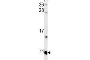 Image no. 2 for anti-S100 Calcium Binding Protein A6 (S100A6) (AA 37-67) antibody (ABIN3032513)