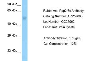 Image no. 1 for anti-Protein Phosphatase 2, Regulatory Subunit B'', gamma (PPP2R3C) (N-Term) antibody (ABIN2787044)