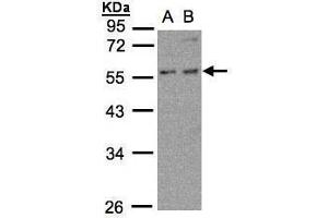 Image no. 1 for anti-6-phosphofructo-2-Kinase/fructose-2,6-Biphosphatase 4 (PFKFB4) (Center) antibody (ABIN2856285)