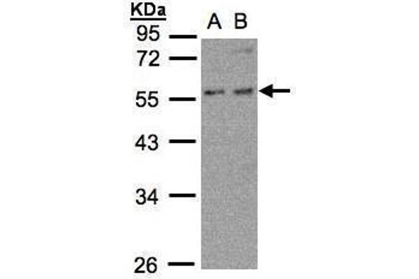 anti-6-phosphofructo-2-Kinase/fructose-2,6-Biphosphatase 4 (PFKFB4) (Center) antibody