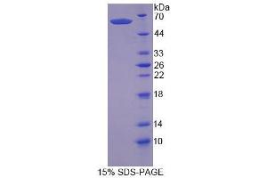 Image no. 1 for Secernin 1 (SCRN1) (AA 2-414) protein (T7 tag,His tag) (ABIN6239206)