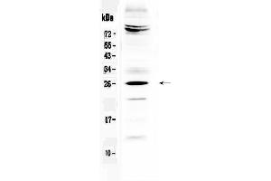 Image no. 1 for anti-Sex Determining Region Y (SRY) (AA 90-130), (Middle Region) antibody (ABIN5518959)