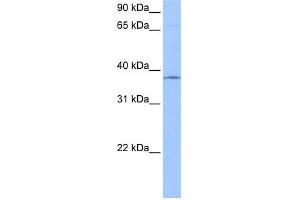 Image no. 1 for anti-Sprouty Homolog 2 (SPRY2) (N-Term) antibody (ABIN2784217)
