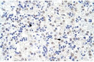 Image no. 3 for anti-Squamous Cell Carcinoma Antigen Recognized By T Cells 3 (SART3) (N-Term) antibody (ABIN2780944)