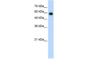 Image no. 1 for anti-SWI/SNF Related, Matrix Associated, Actin Dependent Regulator of Chromatin, Subfamily D, Member 2 (SMARCD2) (C-Term) antibody (ABIN2780464)