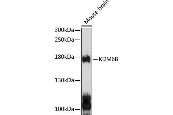 Kdm6b Antikörper  (AA 265-450)