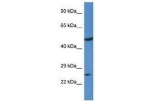 Image no. 1 for anti-Kruppel-Like Factor 17 (KLF17) (N-Term) antibody (ABIN6740644)