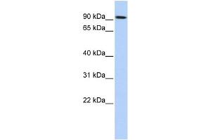 Image no. 1 for anti-Transglutaminase 1, Keratinocyte (TGM1) (N-Term) antibody (ABIN2776952)