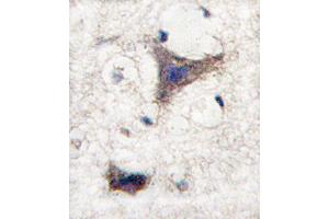 Image no. 1 for anti-Sprouty-Related, EVH1 Domain Containing 1 (SPRED1) (C-Term) antibody (ABIN2503530)