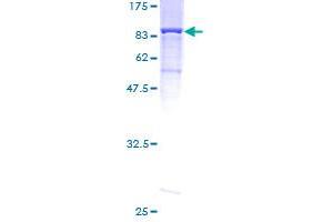 Image no. 1 for Membrane Protein, Palmitoylated 2 (MAGUK P55 Subfamily Member 2) (MPP2) (AA 1-552) protein (GST tag) (ABIN1311218)