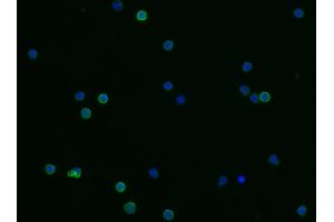 Image no. 1 for anti-Fc Fragment of IgE, Low Affinity II, Receptor For (CD23) (FCER2) (AA 51-331) antibody (ABIN6923521)