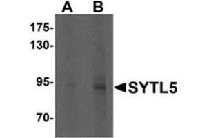 Image no. 1 for anti-Synaptotagmin-Like 5 (SYTL5) (N-Term) antibody (ABIN783534)