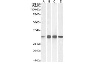 Image no. 2 for anti-Ketohexokinase (KHK) (Internal Region) antibody (ABIN5539547)