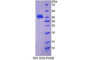 Image no. 1 for Leucine-Rich Repeat LGI Family, Member 3 (LGI3) (AA 261-548) protein (S tag,His tag) (ABIN6237283)