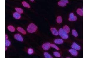 Image no. 3 for anti-Histone Cluster 1, H3d (HIST1H3D) (3meLys27) antibody (ABIN5579862)
