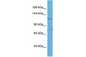 Image no. 4 for anti-Zinc Finger E-Box Binding Homeobox 2 (ZEB2) (N-Term) antibody (ABIN2778075)