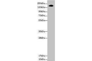 NUP155 antibody  (AA 1102-1391)