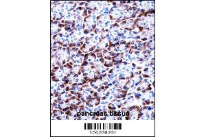 Immunohistochemistry (IHC) image for anti-Coiled-Coil Domain Containing 50 (CCDC50) (Center) antibody (ABIN2159802)