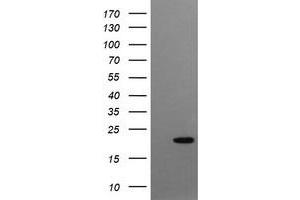 Image no. 1 for anti-Crystallin, gamma C (CRYGC) antibody (ABIN1497651)