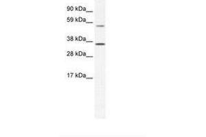 Image no. 1 for anti-Mesoderm Posterior 2 Homolog (Mesp2) (AA 299-348) antibody (ABIN202356)