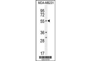 Image no. 1 for anti-Cytochrome P450, Family 2, Subfamily A, Polypeptide 7 (CYP2A7) (AA 121-148) antibody (ABIN654434)