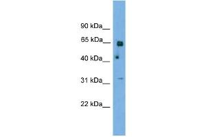 Image no. 1 for anti-Polynucleotide Kinase 3'-Phosphatase (PNKP) (N-Term) antibody (ABIN2774011)